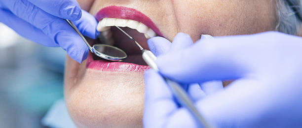 Best Emergency Treatment for Toothache in Stlman Valley, IL